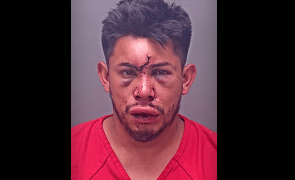 13-year-old boy brutally punishes stepfather who allegedly strangled his mom and also attacked him