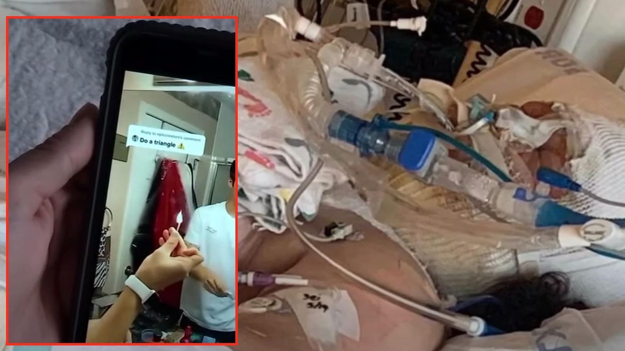 13-year-old severely burned while attempting TikTok challenge, Portland family says