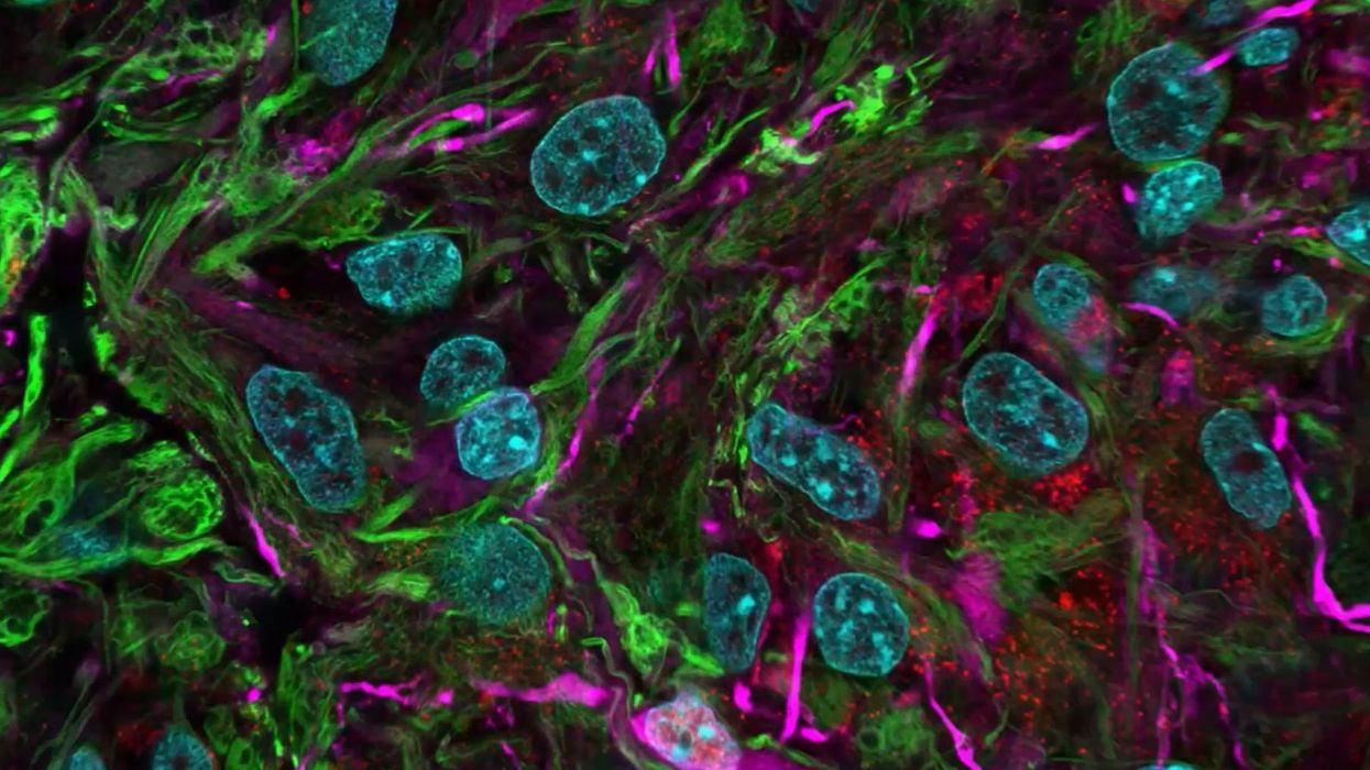 Scientists seek to create 'biocomputers' using lab-grown, human pseudo brains