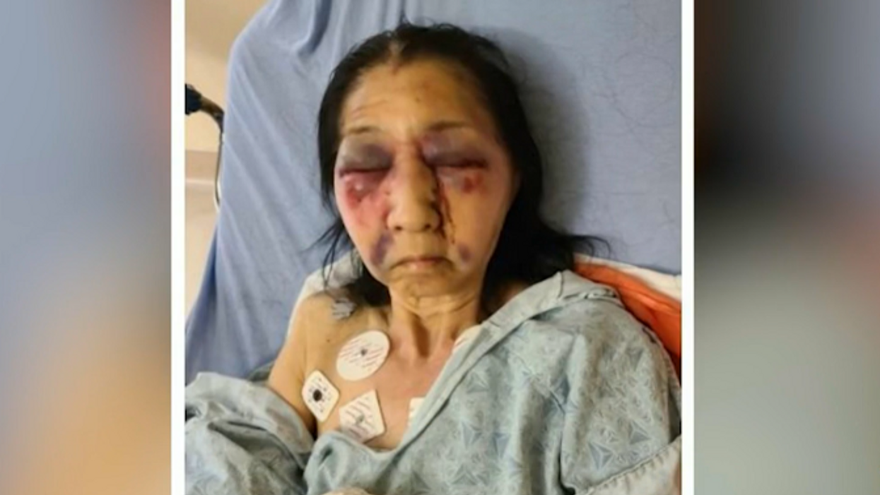 70-year-old Mexican-American grandmother brutally beaten on bus by attacker who thought she was Asian