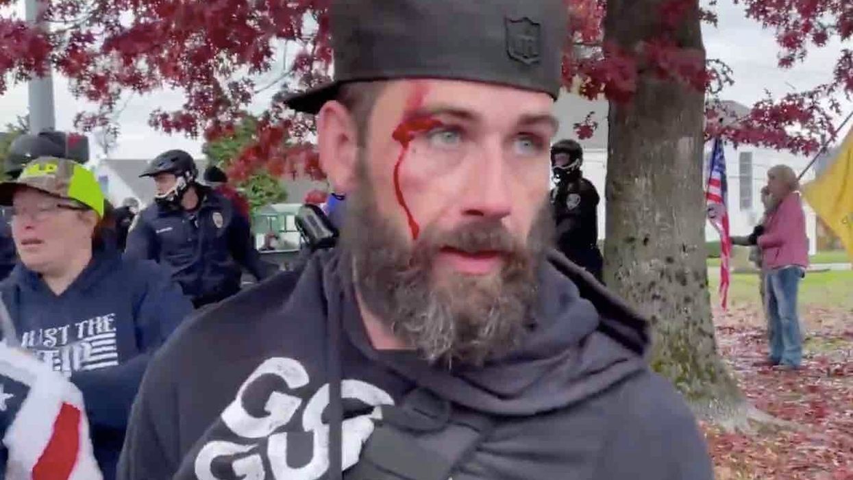 Antifa militants gang up on Trump fans, pummel women to ground — and pro-Trump group responds by singing national anthem