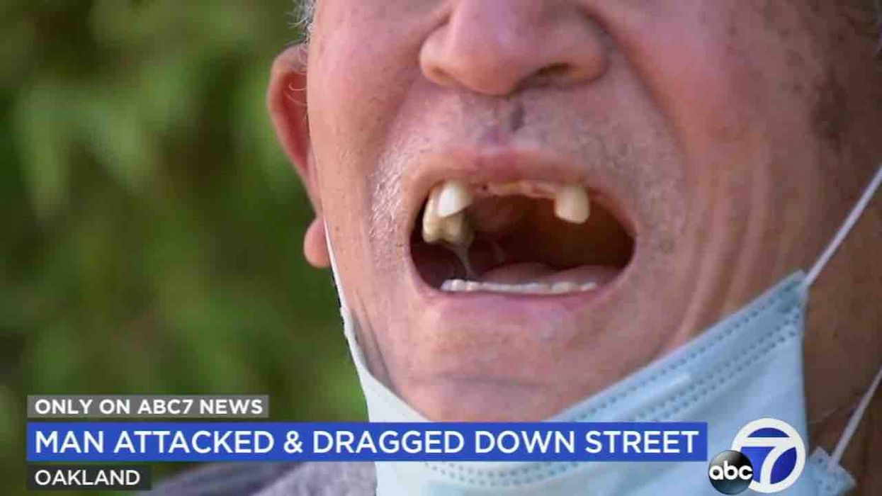 Asian man, 71, loses seven teeth in brutal daylight attack during which he was bitten, robbed, and dragged from car down street