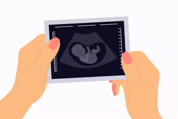 Big Medicine is about to make pregnancy more expensive