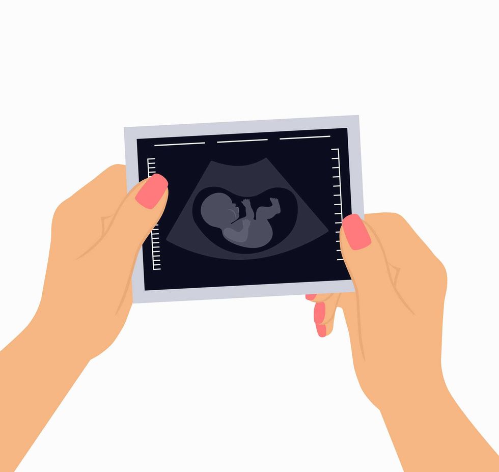 Big Medicine is about to make pregnancy more expensive