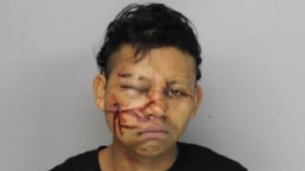 Blaze News original: 13 very unlucky crooks and crime suspects who paid the price in unexpected ways