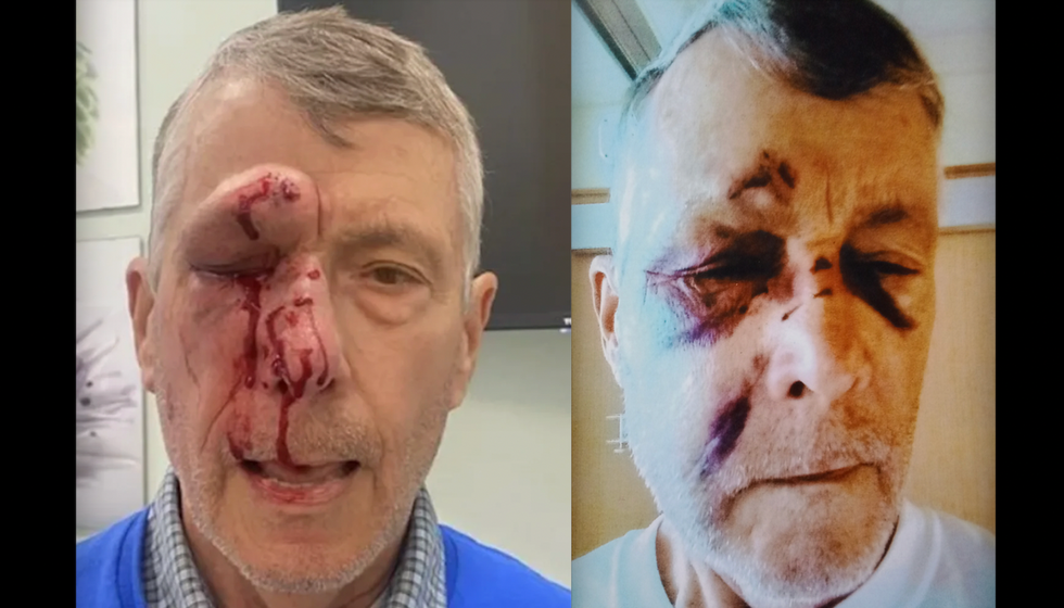 Blaze News original: 'Barbaric' attacker destroys elderly pro-lifer's face outside Planned Parenthood. Victim awaits justice.