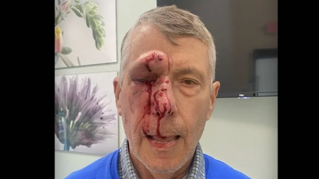 Blaze News original: Crushed faces, broken legs, knockout punches just tip of the iceberg in savage attacks on pro-lifers