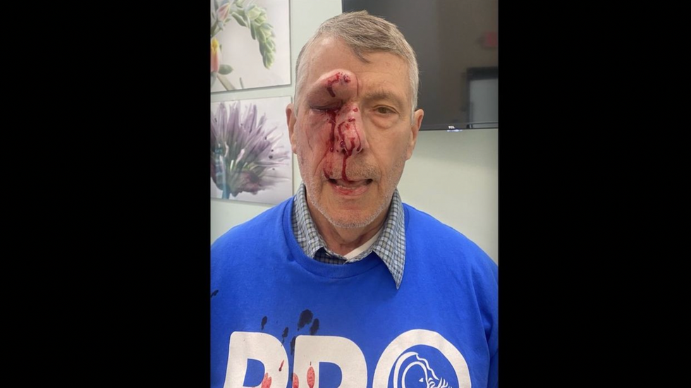 Blaze News original: Elderly pro-lifer energized over new trial for thug who pulverized his face outside Planned Parenthood