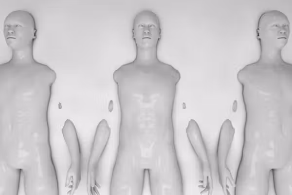 Brainless humans? Backup bodies? Inside biotech's depraved new world