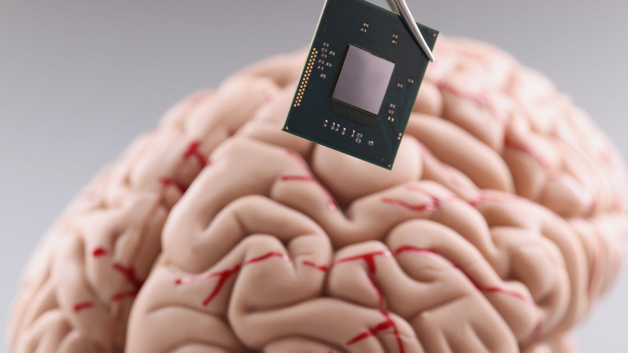 Buy the brain chip, sell your soul? The dark side of Elon's Neuralink dream
