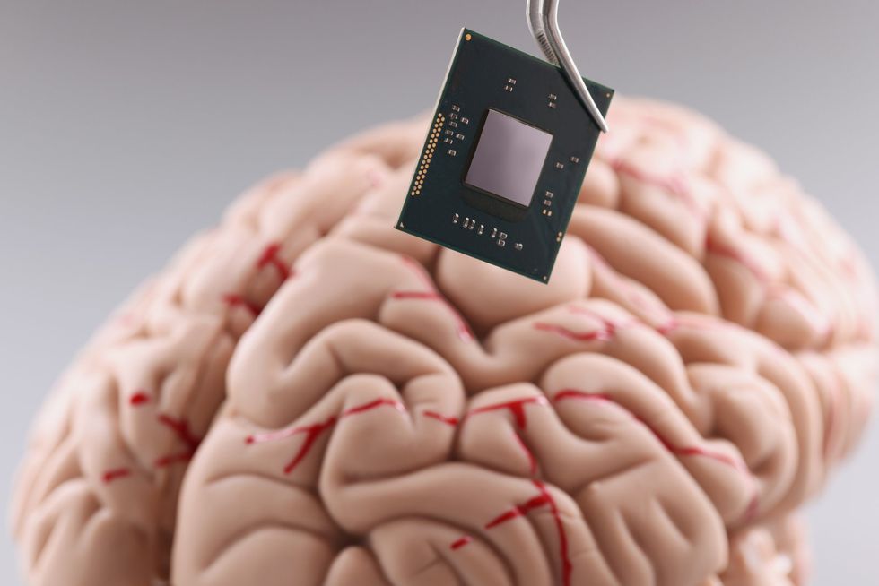Buy the brain chip‚ sell your soul? The dark side of Elon's Neuralink dream