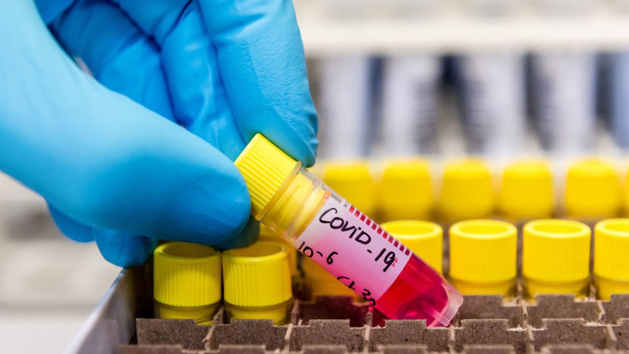 Coronavirus test vials