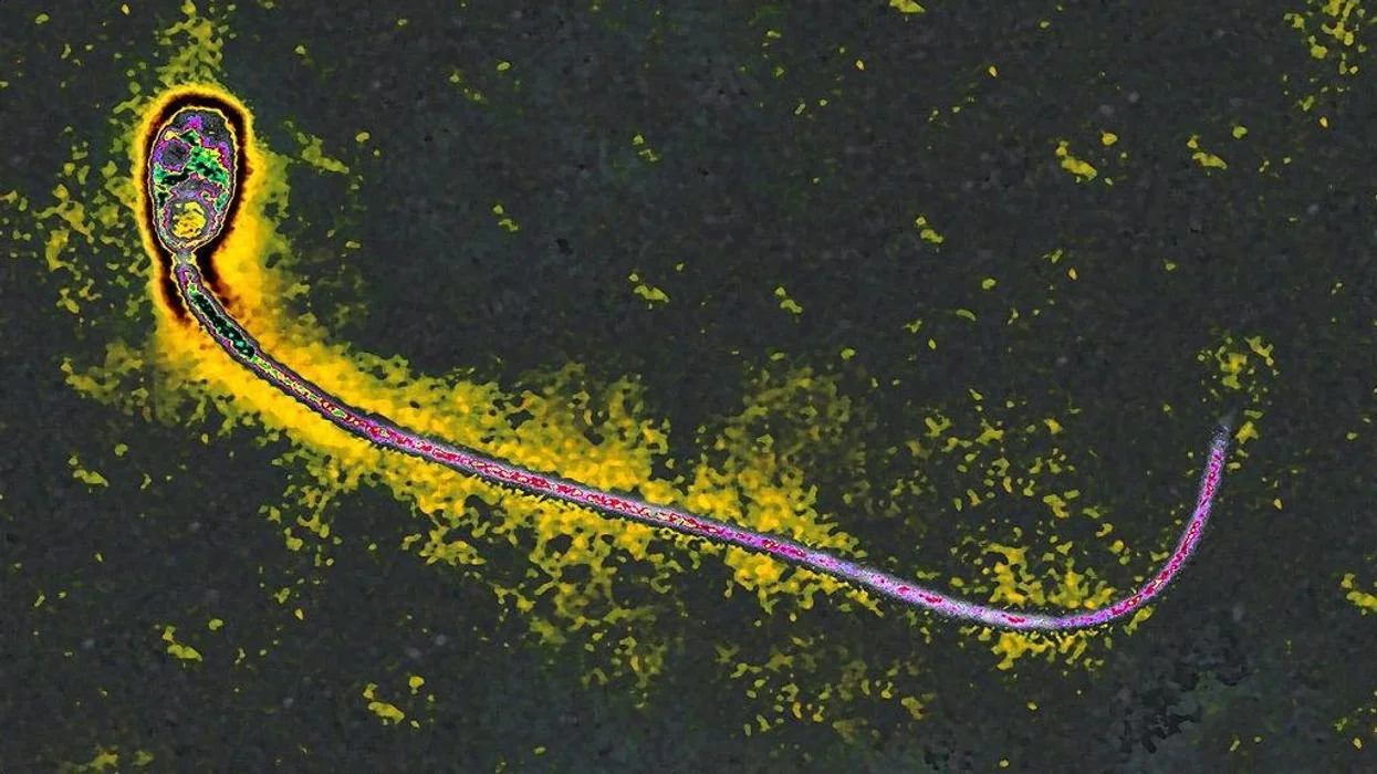 Crazy 'cat lady' parasite decapitates sperm, 'colonizes' testes