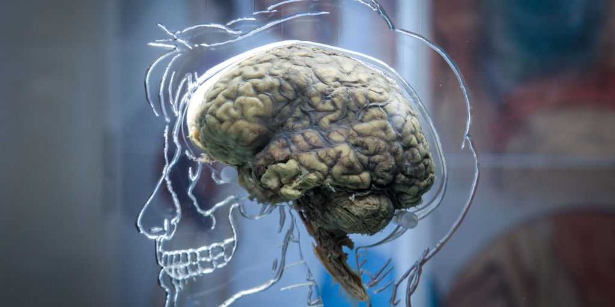 Disembodied human brains kept 'alive' for drug testing by controversial American startup