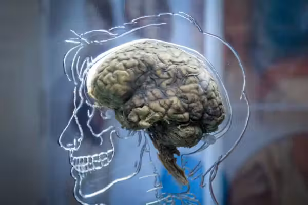 Disembodied human brains kept 'alive' for drug testing by controversial American startup