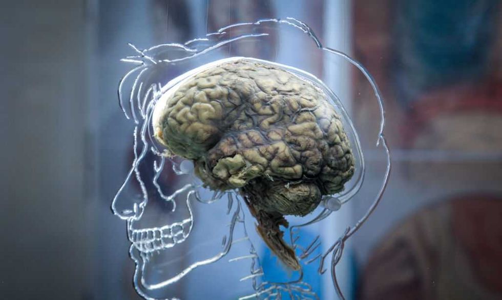 Disembodied human brains kept 'alive' for drug testing by controversial American startup