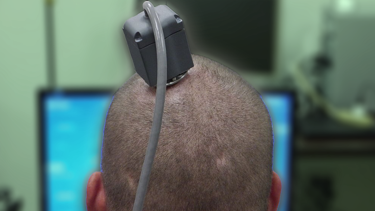 Dystopia: World's first 'biological computer' uses human brain cells that are 'raised in a simulation'