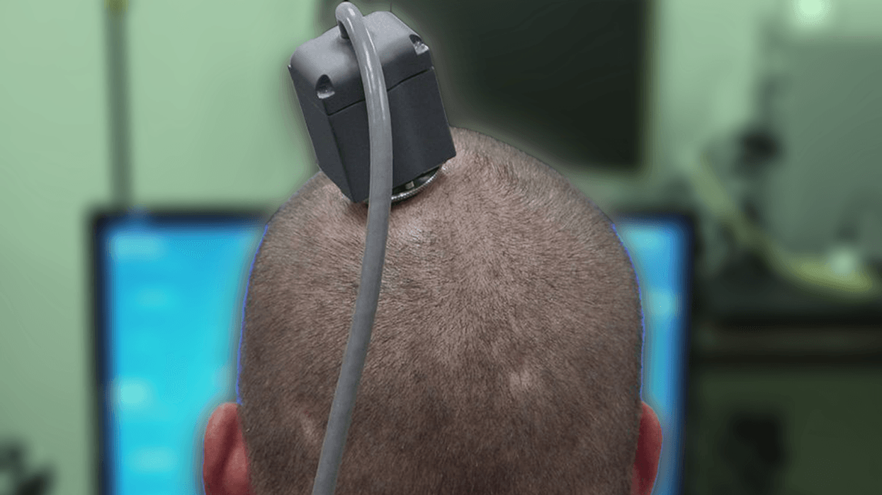 Dystopia: World's first 'biological computer' uses human brain cells ...