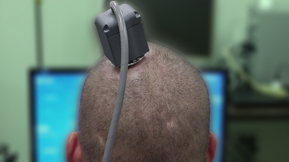 Dystopia: World's first 'biological computer' uses human brain cells that are 'raised in a simulation'
