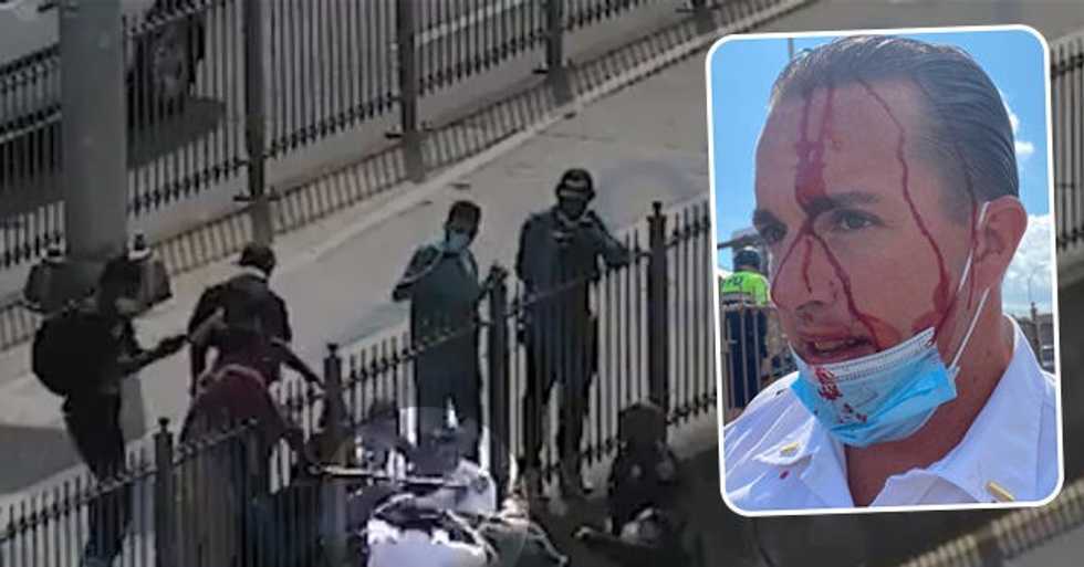 Protesters Attack and Bloody NYPD Officers in Broad Daylight