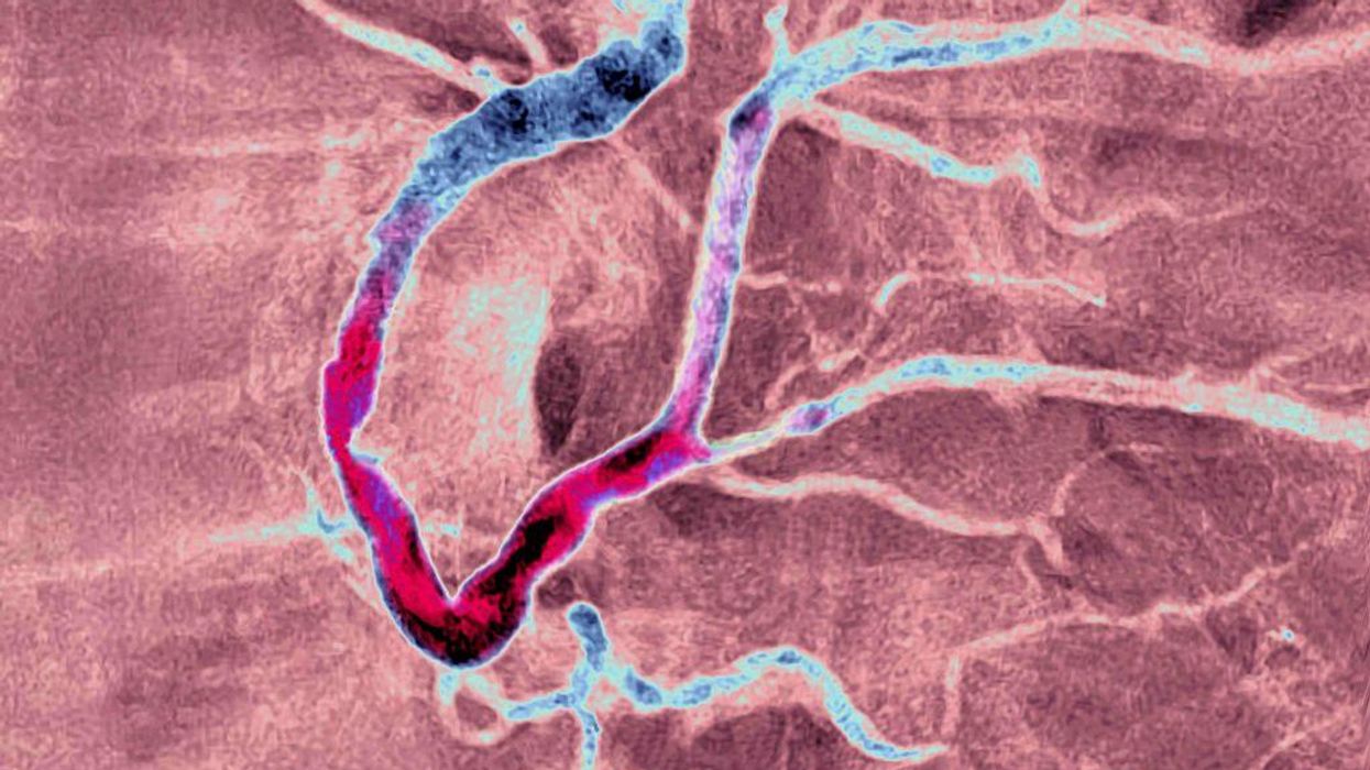 Feds reject Florida surgeon general's warnings about dangers of mRNA vaccinations