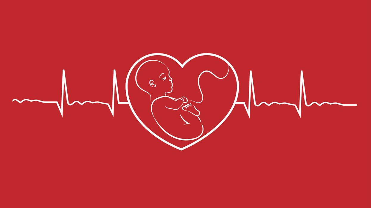For the unborn child, it’s pro-life or pro-death