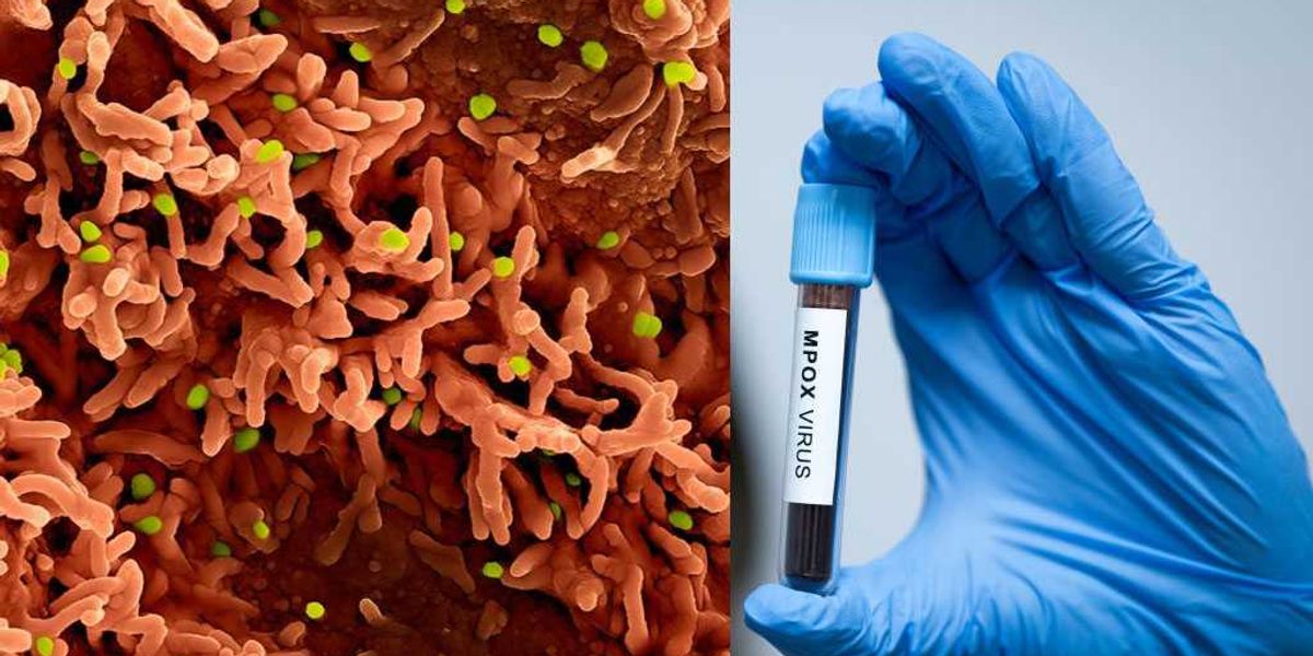 Foreign 'Fauci acolyte' and his African crony charged with smuggling monkeypox onto American soil