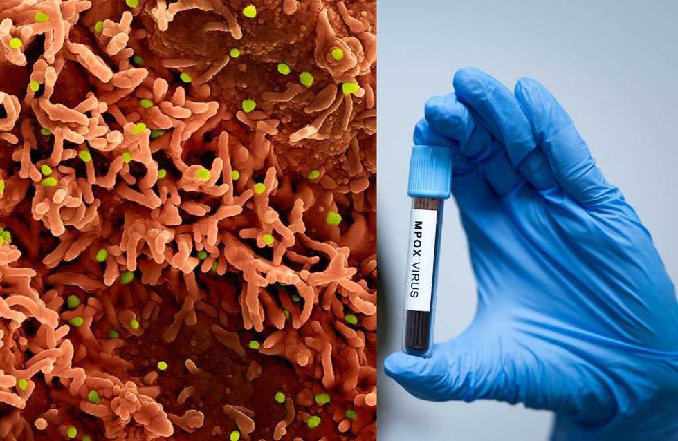 Foreign 'Fauci acolyte' and his African crony charged with smuggling monkeypox onto American soil
