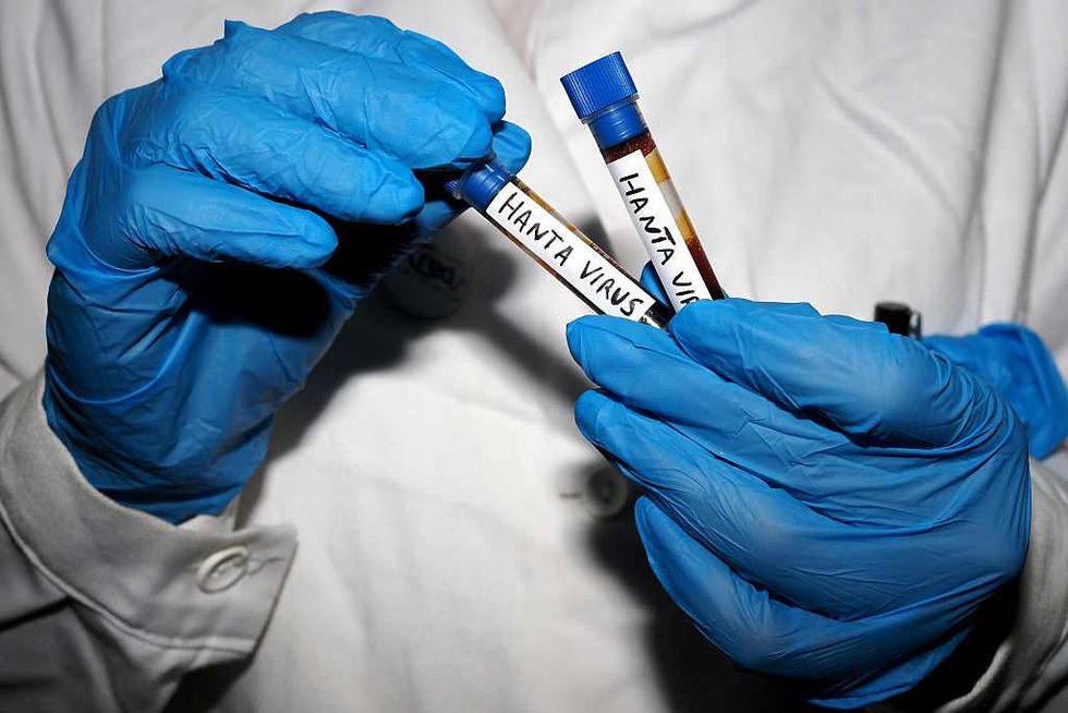 Gain-of-function experiments on hantaviruses? Yes, but virus threat is still MASSIVELY overblown.