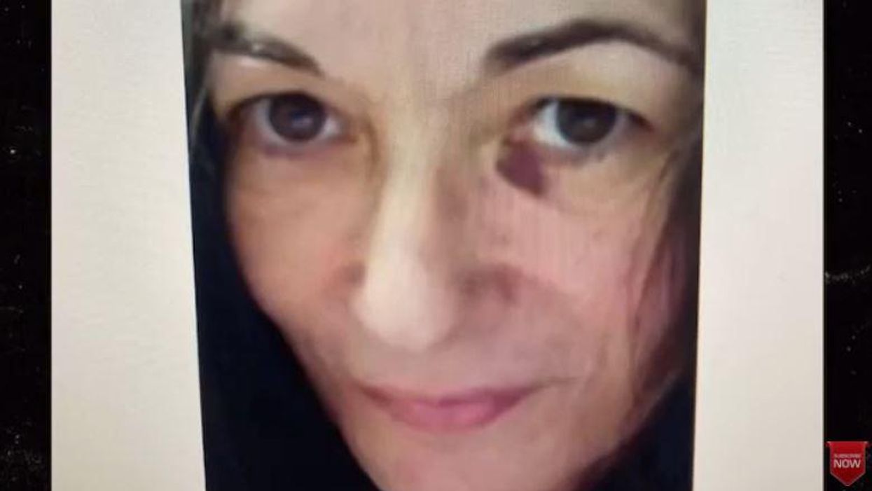Ghislaine Maxwell has unexplained black eye in first photo from prison