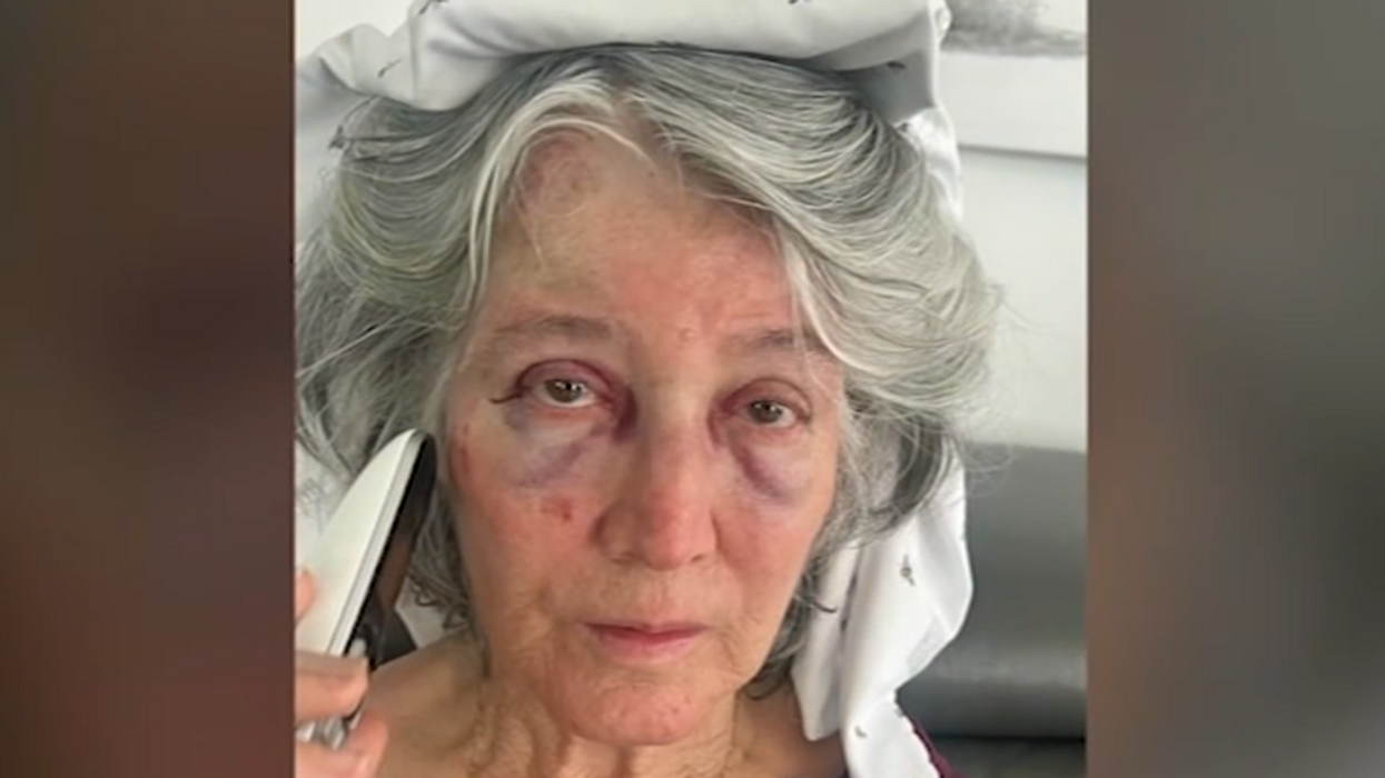 Grandmother beaten at California bus stop, falls into road from random attack