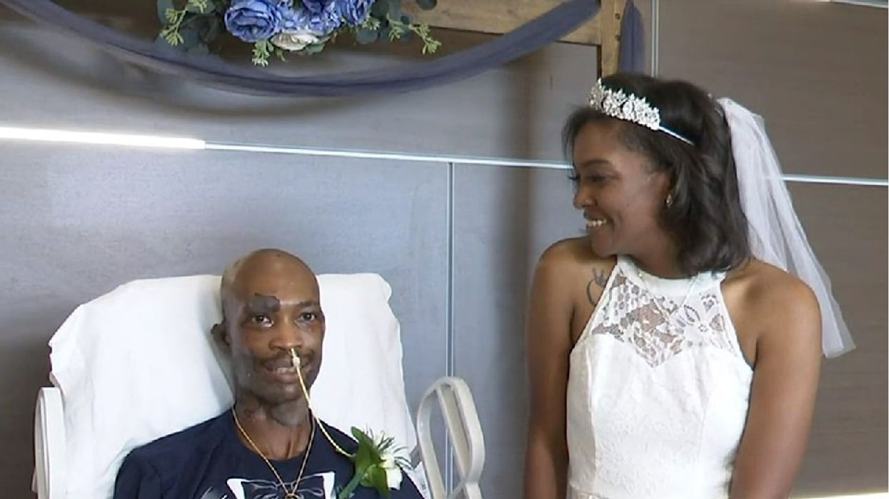 Groom-to-be worried that fiancée wouldn't marry him after he suffered serious chemical burns — but she never wavered: 'There’s nothing that would stop me'