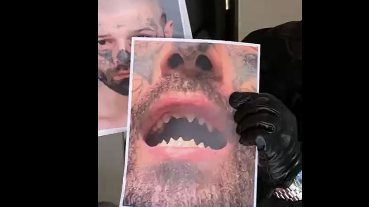 'He's a monster': Man with sharpened teeth accused of imprisoning and violating pregnant woman for weeks, threatening to 'rip out her throat'