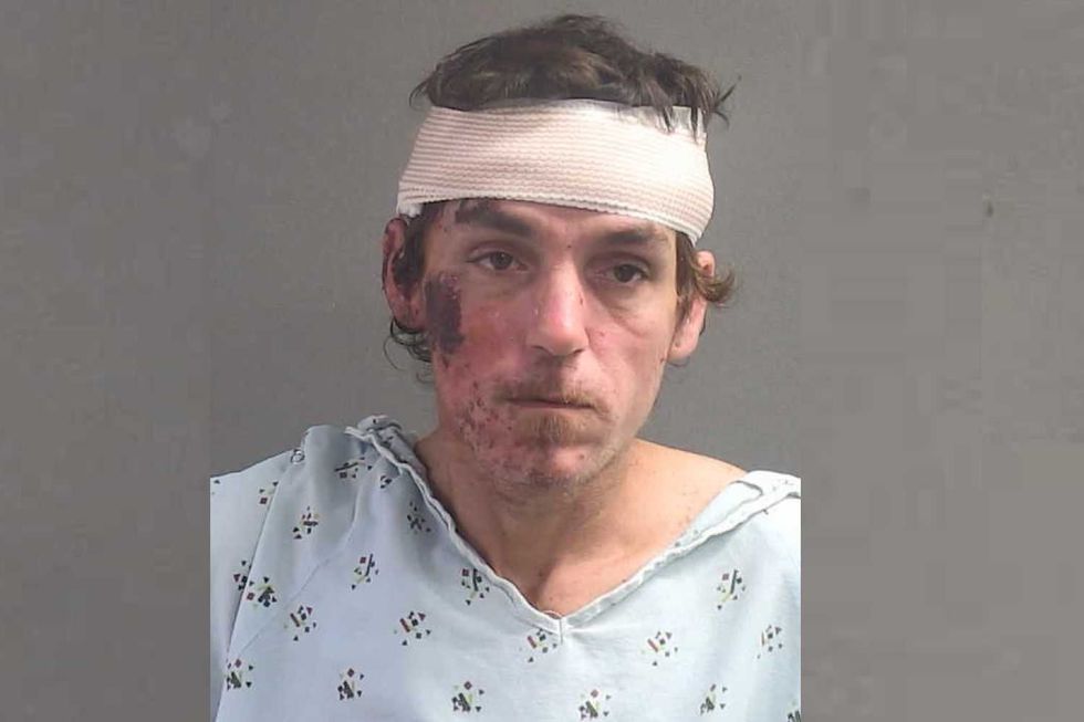 Homeless man allegedly choked 13-year-old at school bus stop until Good Samaritan beat his face with a toolbox