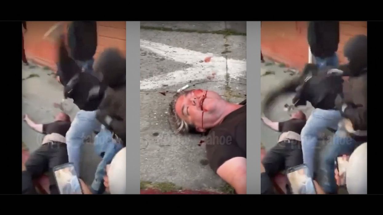 Horrific video: Man beaten to bloody pulp by masked thugs angry he confronted their dangerous intersection takeover