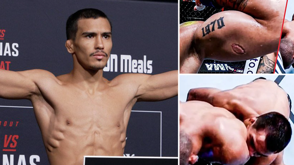 'I was on autopilot. I don’t remember anything': Ex-UFC fighter apologizes for biting opponent‚ asks for shot at redemption