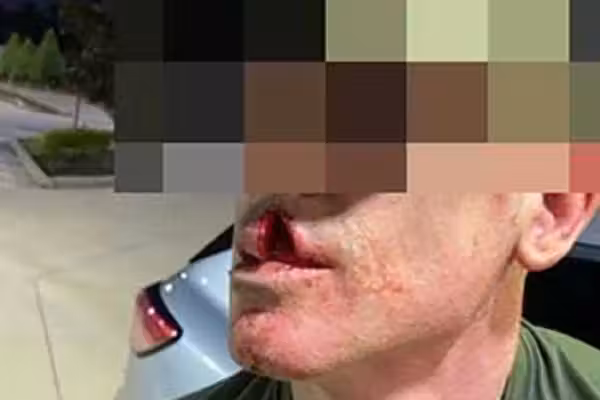 Illegal alien pedophile allegedly 'physically assaulted' ICE agent during immigration operation: DHS