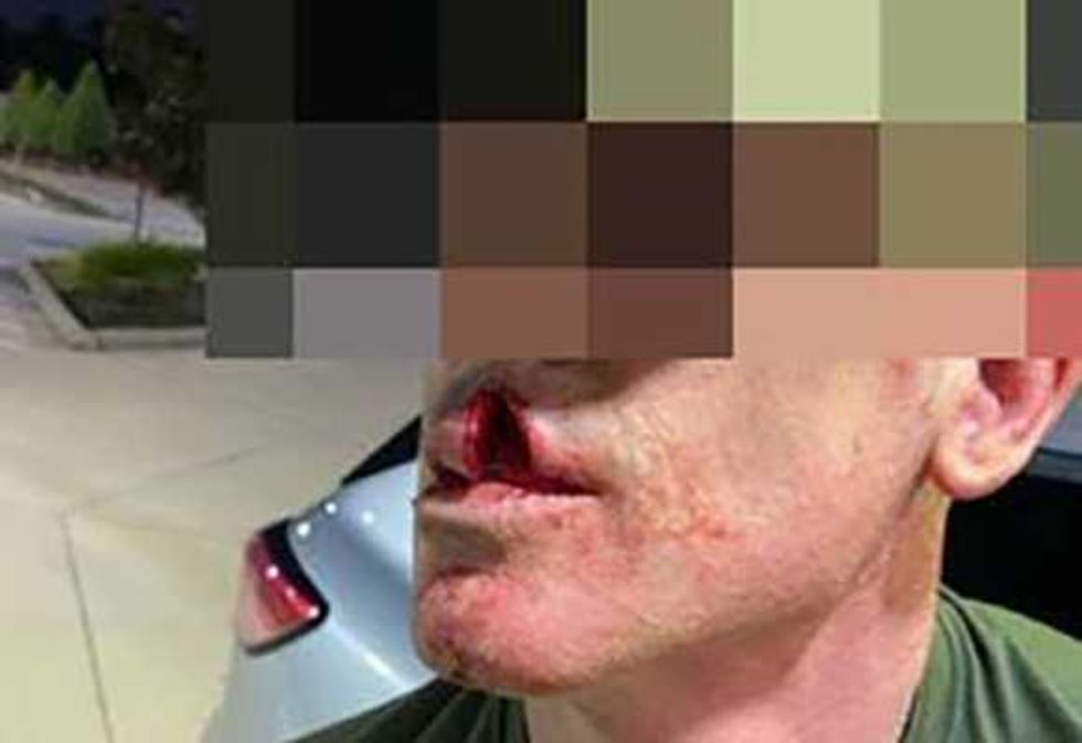 Illegal alien pedophile allegedly 'physically assaulted' ICE agent during immigration operation: DHS