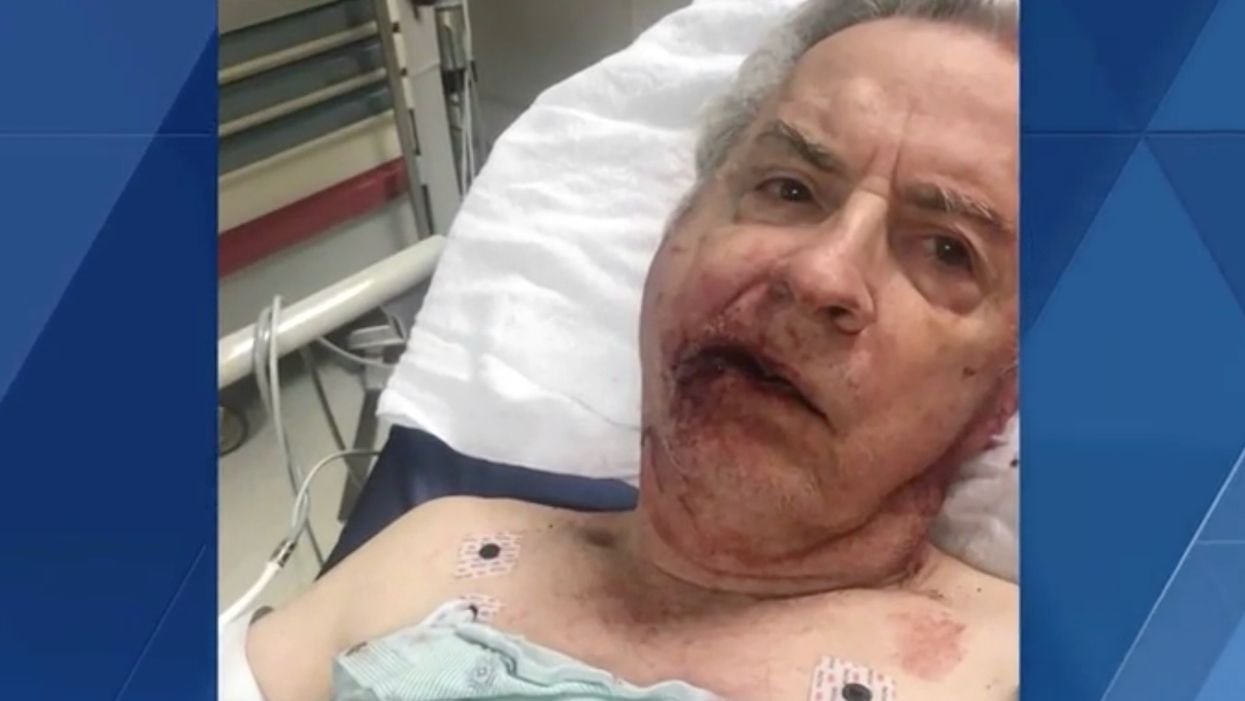 Attacker reportedly sucker punches 76-year-old disabled man over parking spot — and he’s still on the loose