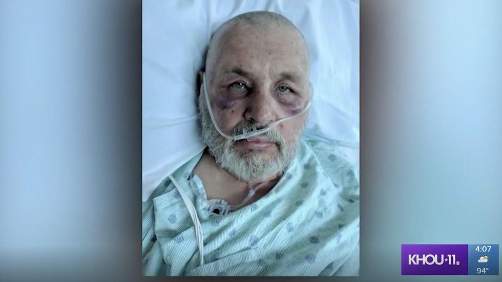 Texas man in serious condition after being stung over 600 times by Africanized bees