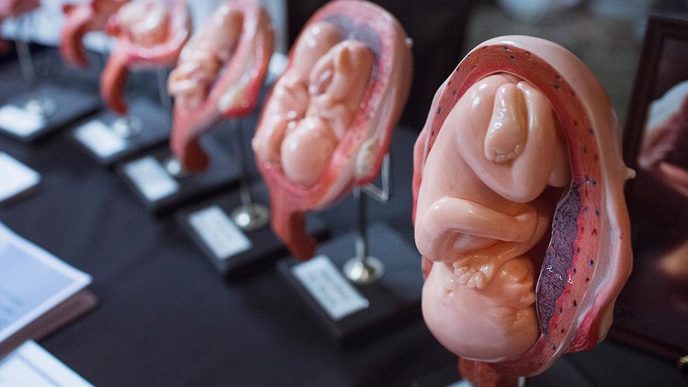 Court upholds Louisiana law to protect women from unsafe abortion clinic practices