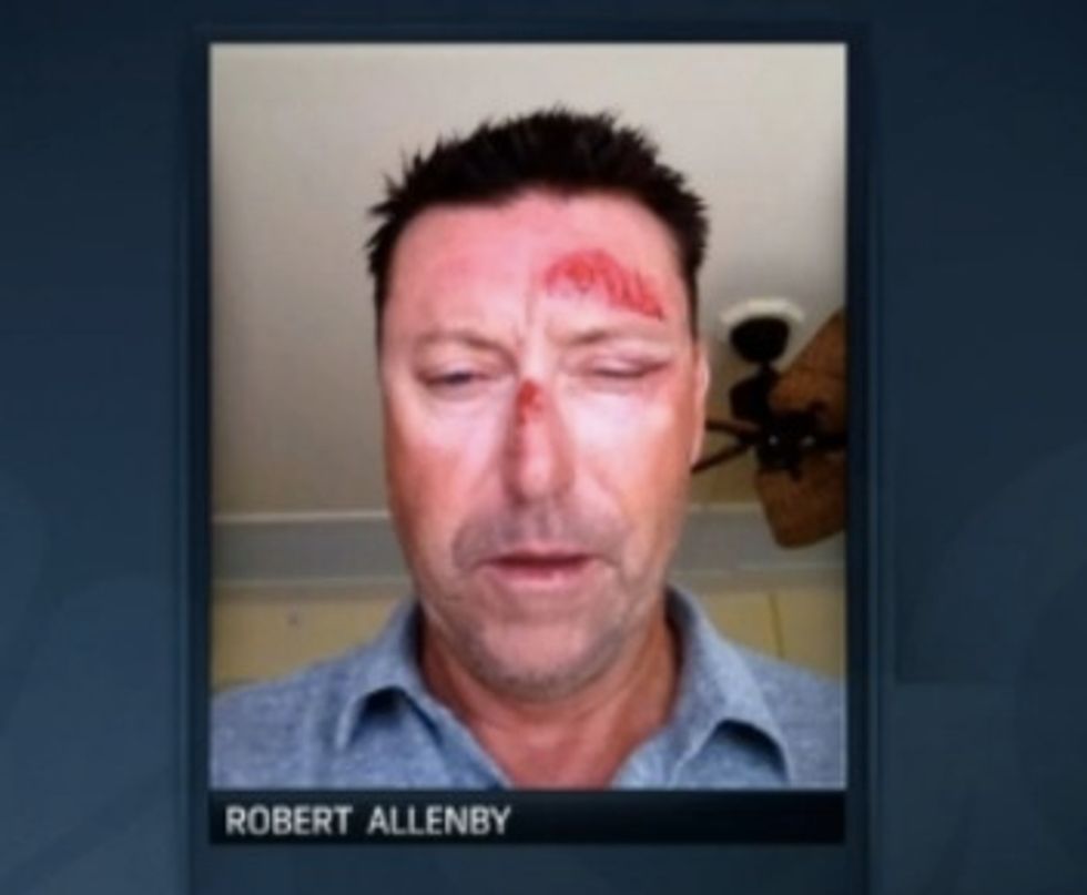 PGA Golfer Beaten, Kidnapped and Robbed After Evening at Wine Bar: Report