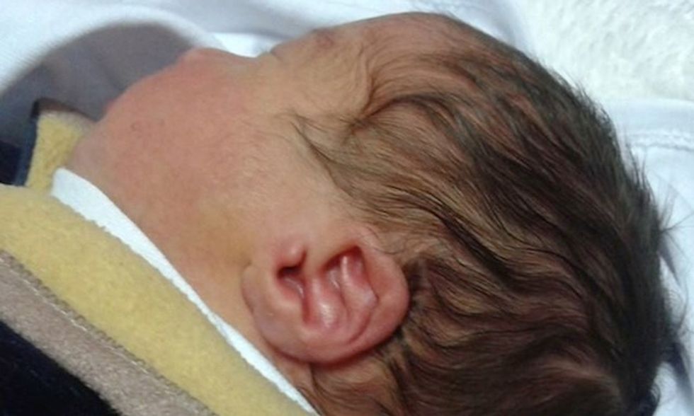 Palestinians Say This Baby’s Ear Is Shaped Like the Word 'Allah\