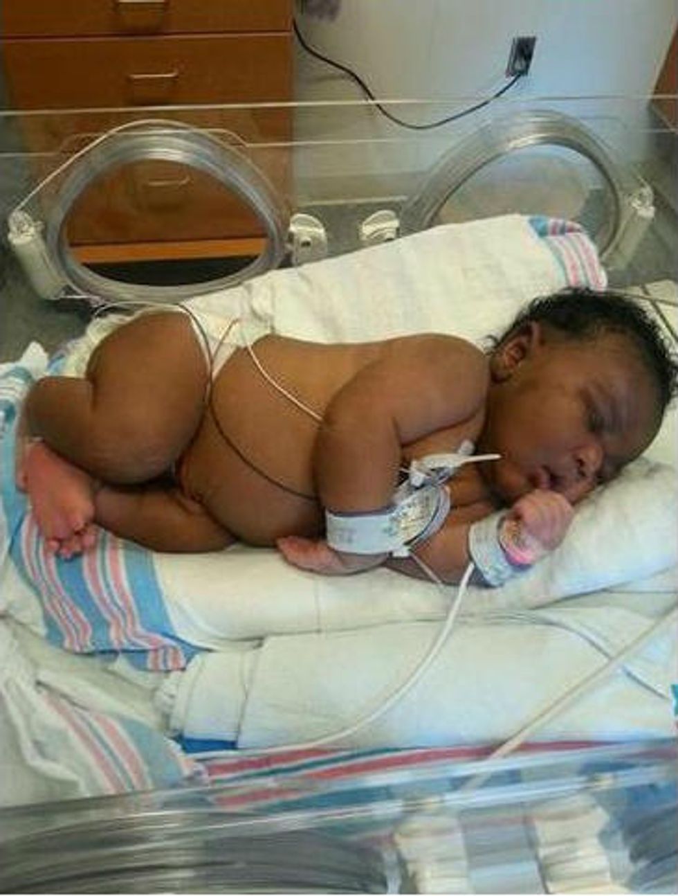 Woman Who Had No Idea She Was Pregnant Until 35 Weeks Delivers 14-Pound Baby