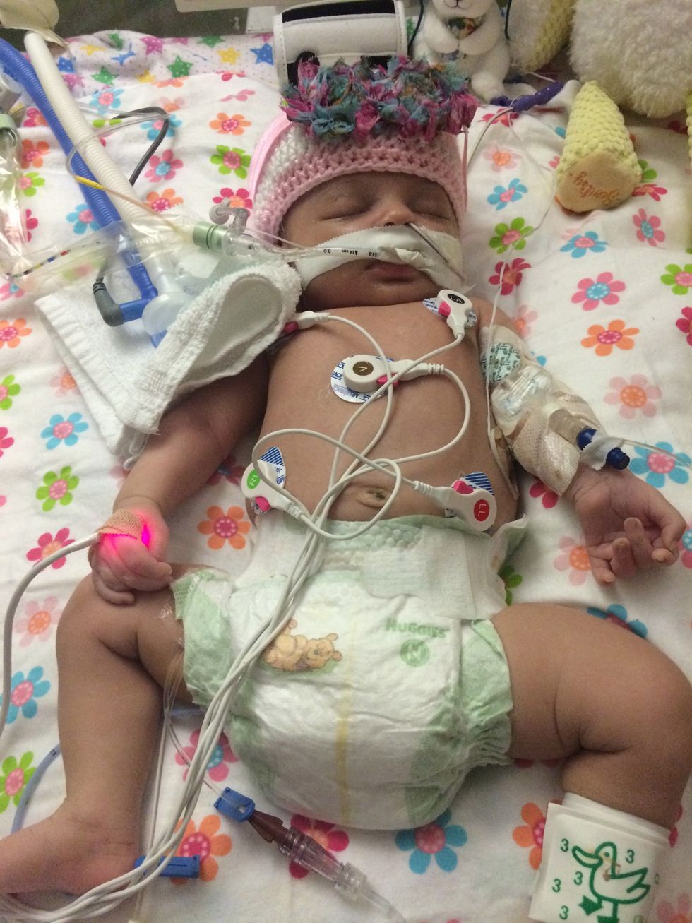 Doctors Said This Baby's Condition Was 'Incompatible With Life,' but When They Removed Her Ventilator Something 'Miraculous' Happened