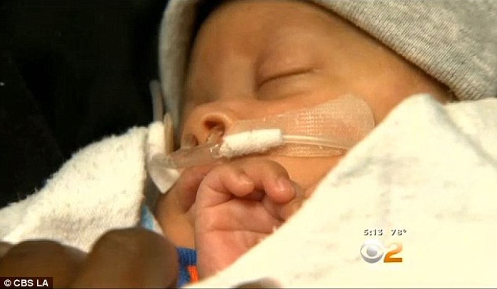 Premature Baby Leaves Doctors Absolutely Stunned in Delivery Room: ‘It Really Felt Like a Moment of Awe’