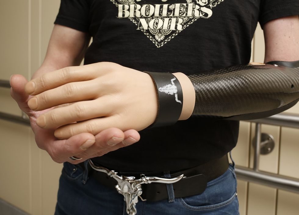 Three Men Transfer Messages From 'Mind to Metal' With the First 'Bionic' Hands