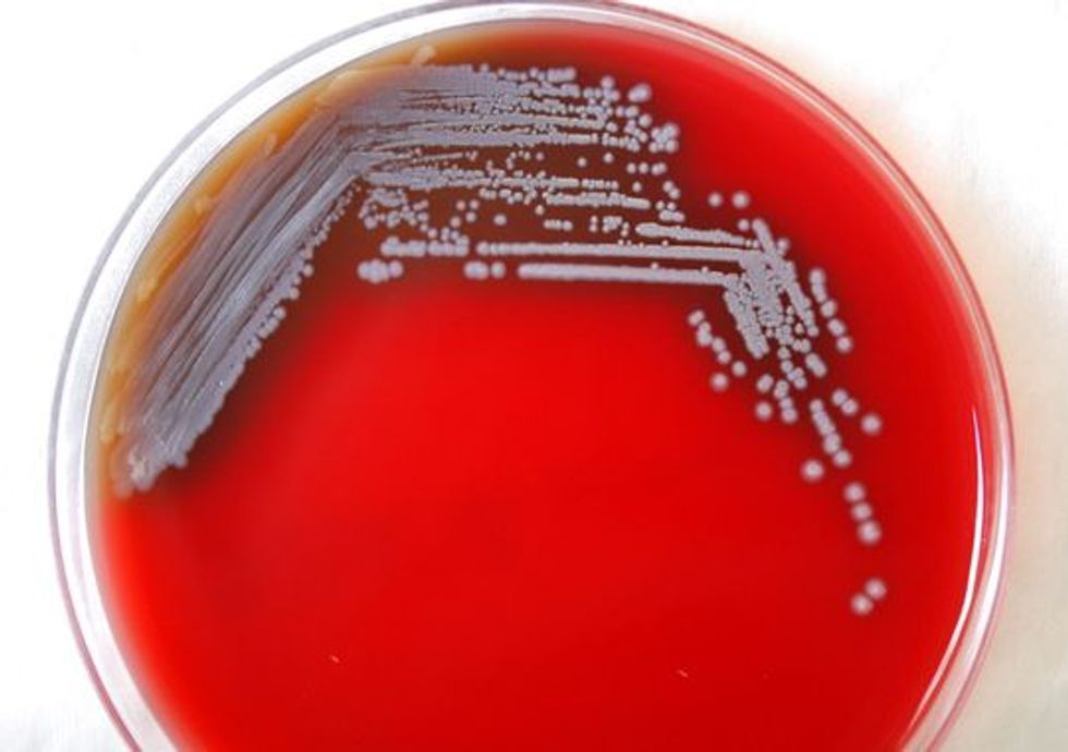 Deadly Bacteria Escapes Lab in 'Disturbing' Incident: 'We're Taking This Extraordinarily Seriously