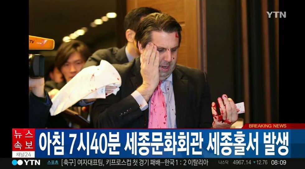 U.S. Ambassador to South Korea Mark Lippert Injured After Being Attacked By Man Wielding Razor Blade