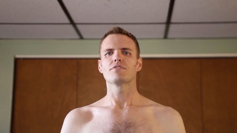 This Is What's Left': Man Takes Off Shirt to Reveal Loose Skin After Losing 390 Pounds in One Year